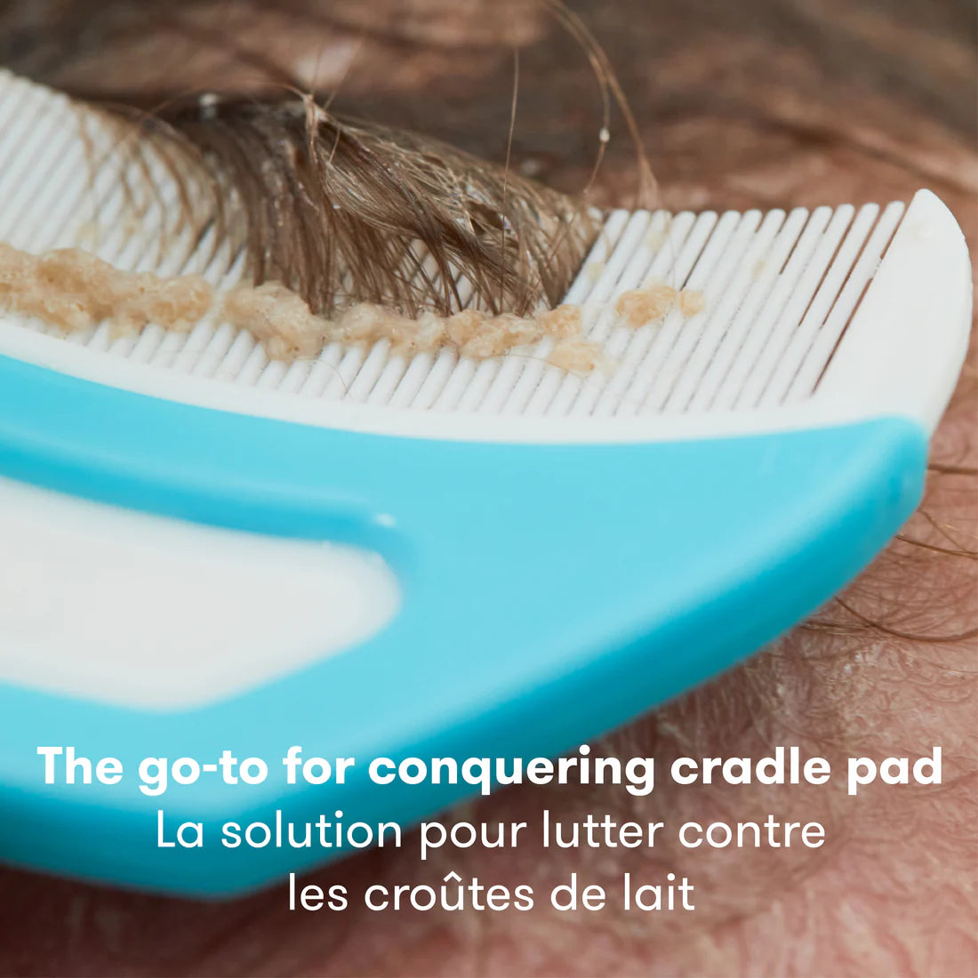 SYSTÈME DE CROÛTES DE LAIT 3 EN 1 - Institut MAIA