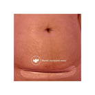 PANSEMENT EN SILICONE POUR CICATRICE DE CÉSARIENNE - Institut MAIA